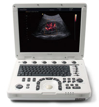 Load image into Gallery viewer, MEDISON MySono U5. With one MEDISON 3D2-6 (U5) 3D/4D Ultrasound Probe Used
