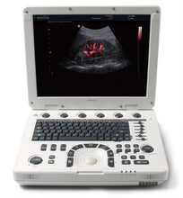 Load image into Gallery viewer, MEDISON MySono U5. With one MEDISON 3D2-6 (U5) 3D/4D Ultrasound Probe Used
