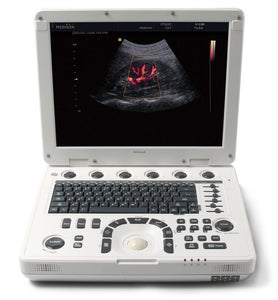 MEDISON MySono U5. With one MEDISON 3D2-6 (U5) 3D/4D Ultrasound Probe Used