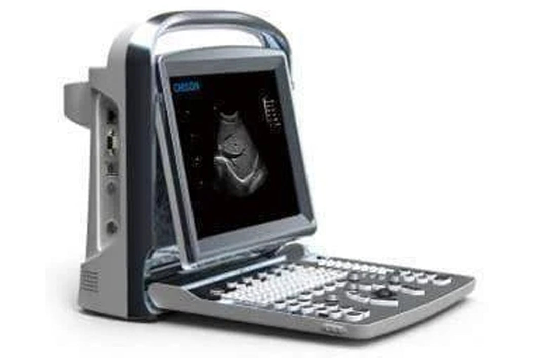 Chison ECO1 Ultrasound  Used