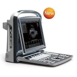 Chison ECO1 Ultrasound