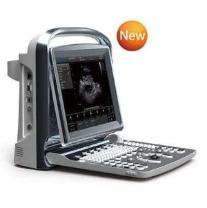 Chison ECO1 Ultrasound