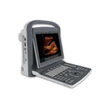 Chison ECO2 - Powerful and Affordable B&W Ultrasound